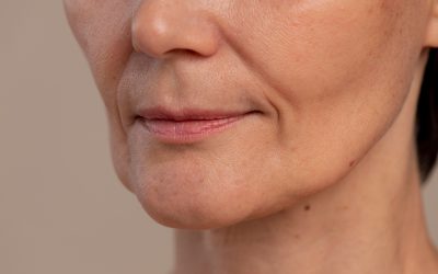 Mentón proyectado sin cirugía: rellenos de ácido hialurónico vs implantes