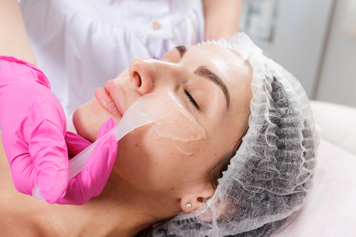 tratamiento de peeling facial en Barcelona